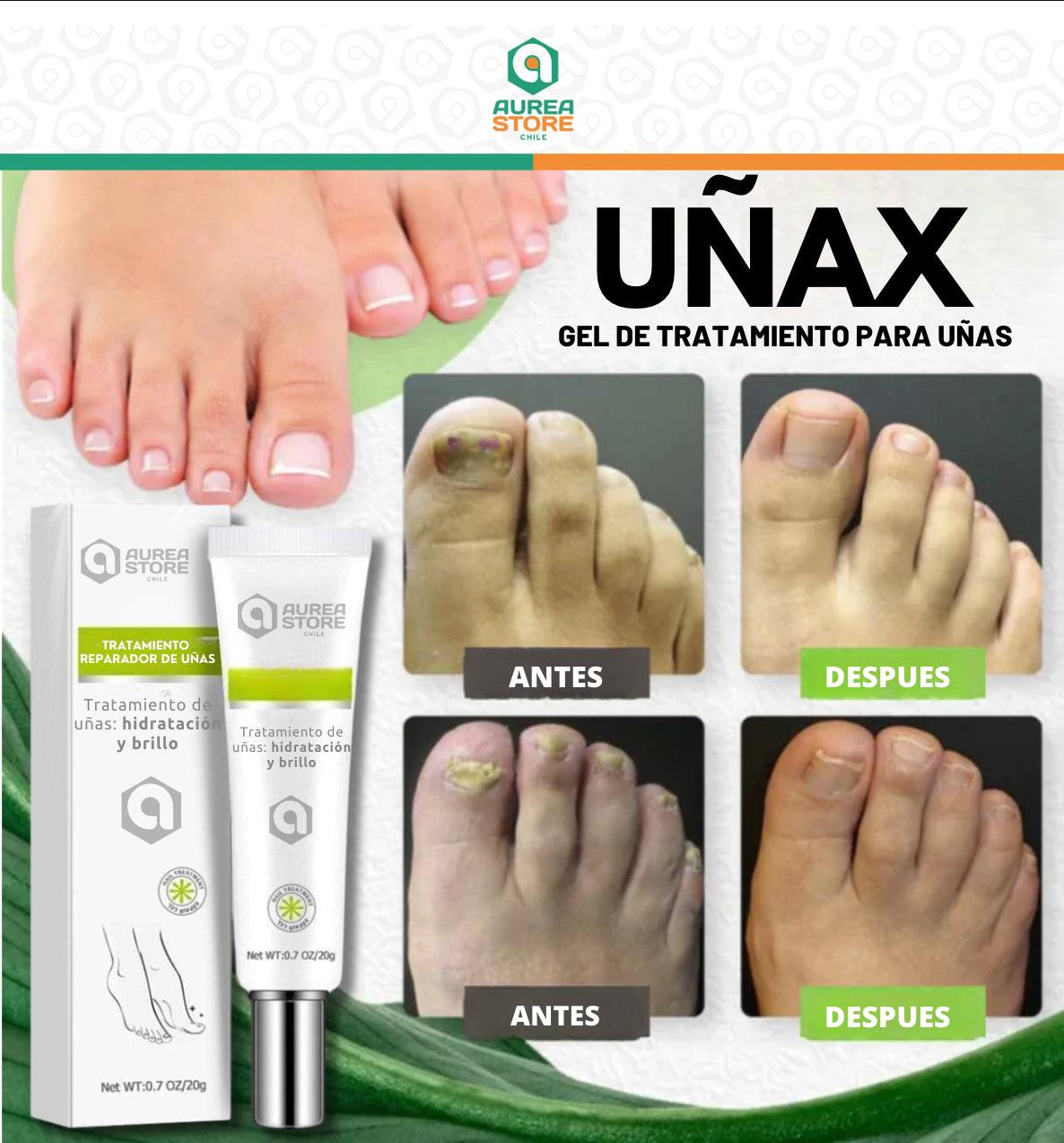 UÑAX™ - Gel de Tratamiento para Uñas [DESCUENTOS IMPERDIBLES]