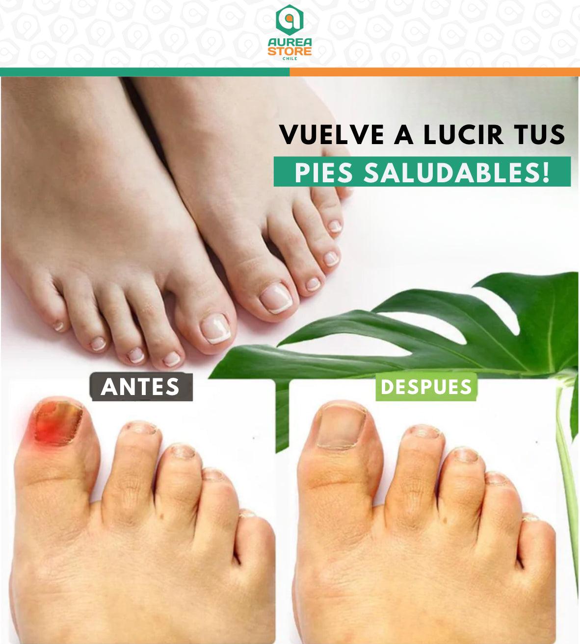 UÑAX™ - Gel de Tratamiento para Uñas [DESCUENTOS IMPERDIBLES]