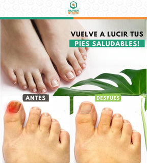 UÑAX™ - Gel de Tratamiento para Uñas [DESCUENTOS IMPERDIBLES]