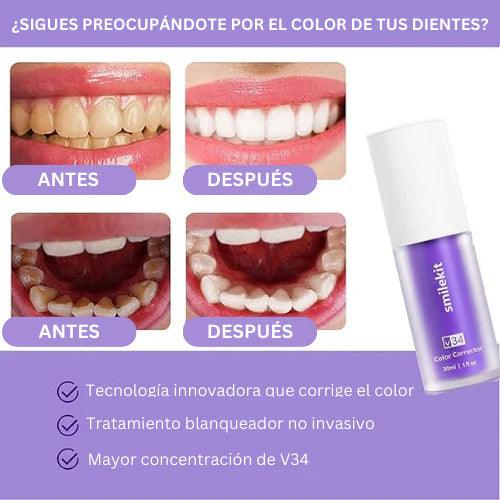 Blanqueador Dental | SmileKit [RECIEN LLEGADO]